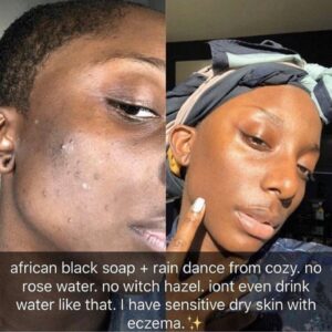 a2e6971261a7893528645f332298160b